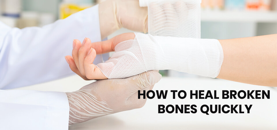 How to Heal Broken Bones Quickly? | Broken Bone Doctor