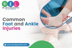 Common Foot and Ankle Injuries