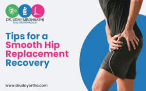 Hip Replacement