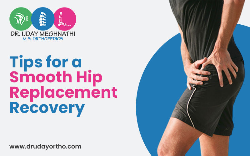 Hip Replacement
