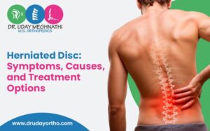 Herniated Disc