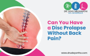 Disc Prolapse Without back Pain