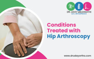 Hip Arthroscopy