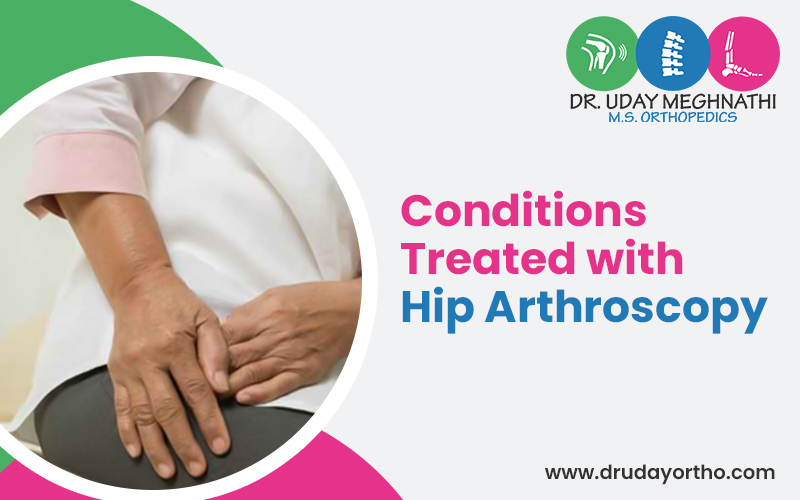 Hip Arthroscopy