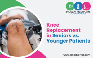 Knee Replacement in Senior & Younger Patients