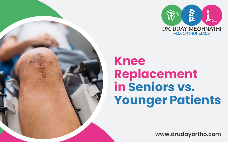 Knee Replacement in Senior & Younger Patients