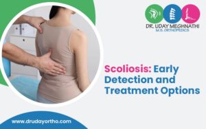 Scoliosis