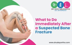 What to Do Immediately After a Suspected Bone Fracture