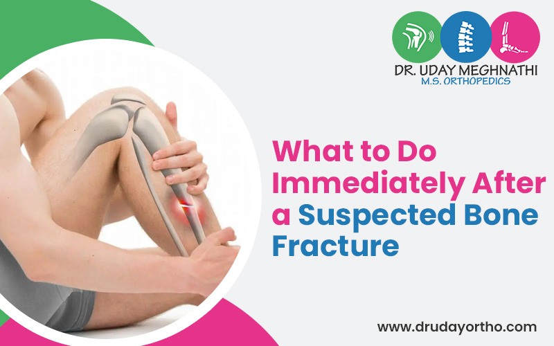What to Do Immediately After a Suspected Bone Fracture