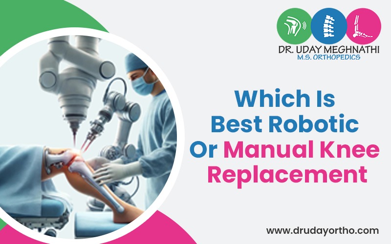 Which Is Better, Robotic or Manual Knee Replacement
