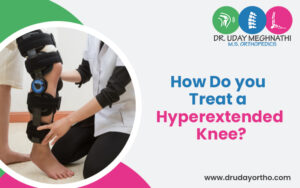 How Do You Treat a Hyperextended Knee