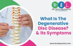What Is The Degenerative Disc Disease & Its Symptoms