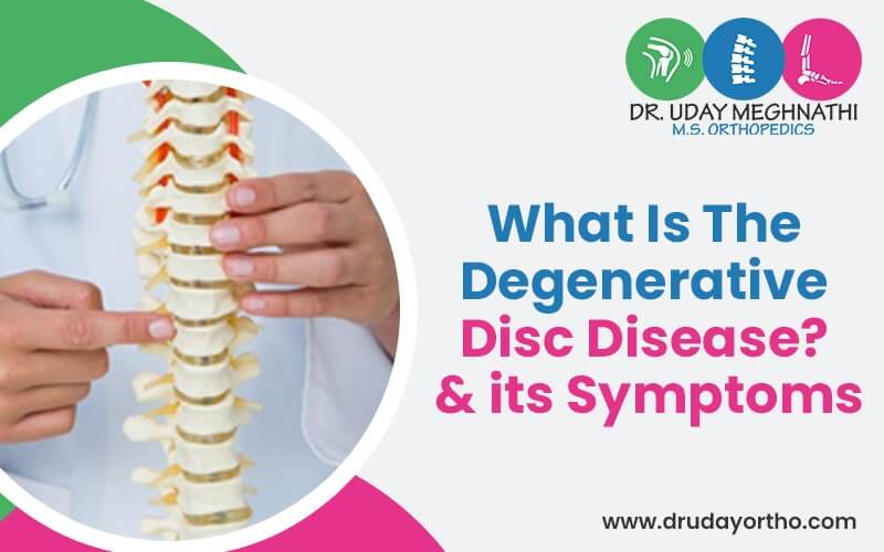 What Is The Degenerative Disc Disease & Its Symptoms
