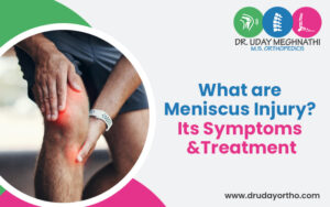 What is a Meniscus Injury