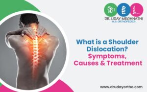 What is a Shoulder Dislocation