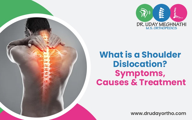 What is a Shoulder Dislocation