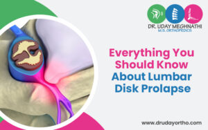 What is Lumbar Disk Prolapse