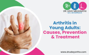 Arthritis in Young Adults