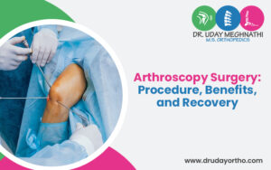 Arthroscopy Surgery