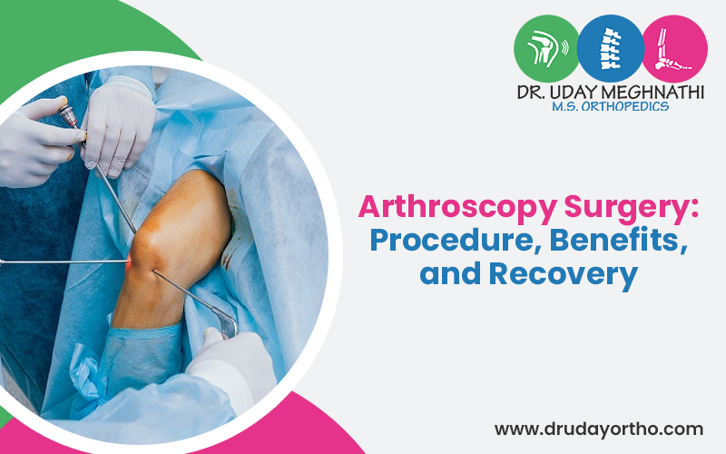 Arthroscopy Surgery