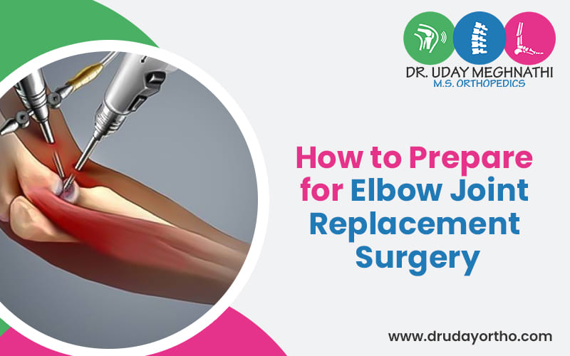 How to Prepare for Elbow Joint Replacement Surgery