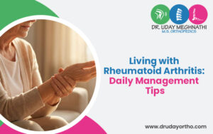 Living with Rheumatoid Arthritis
