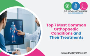 Top 7 Most Common Orthopedic Conditions and Their Treatments