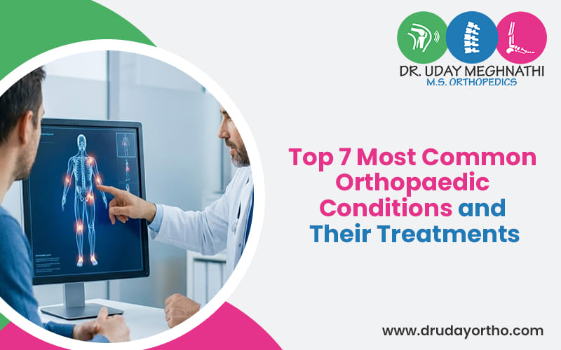 Top 7 Most Common Orthopedic Conditions and Their Treatments