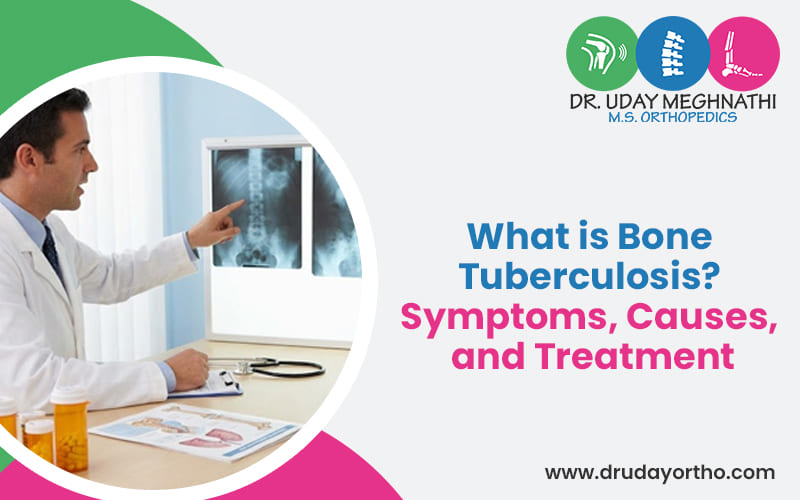 What is Bone Tuberculosis