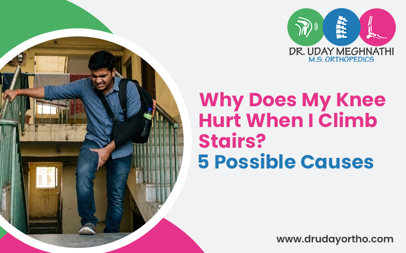 Causes for Knee Pain When Climbing Stairs
