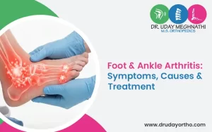 Foot & Ankle Arthritis